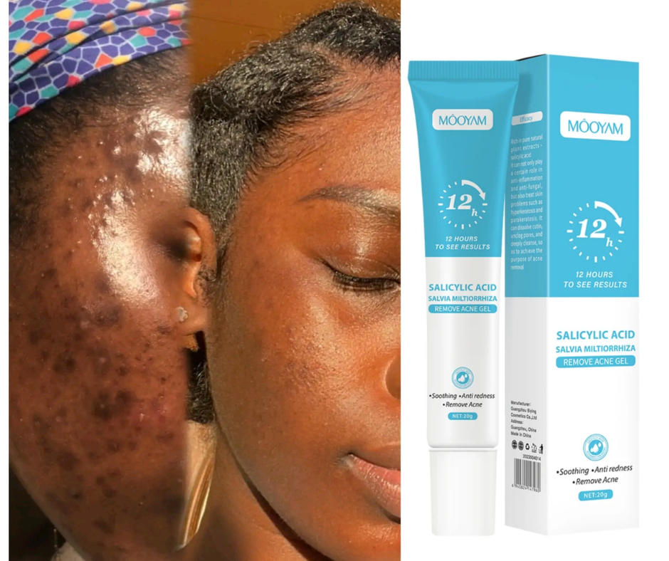 Gel Anti Acné & Anti Taches | Acide Salicylique 2% | Peau Nette en 7 Jours