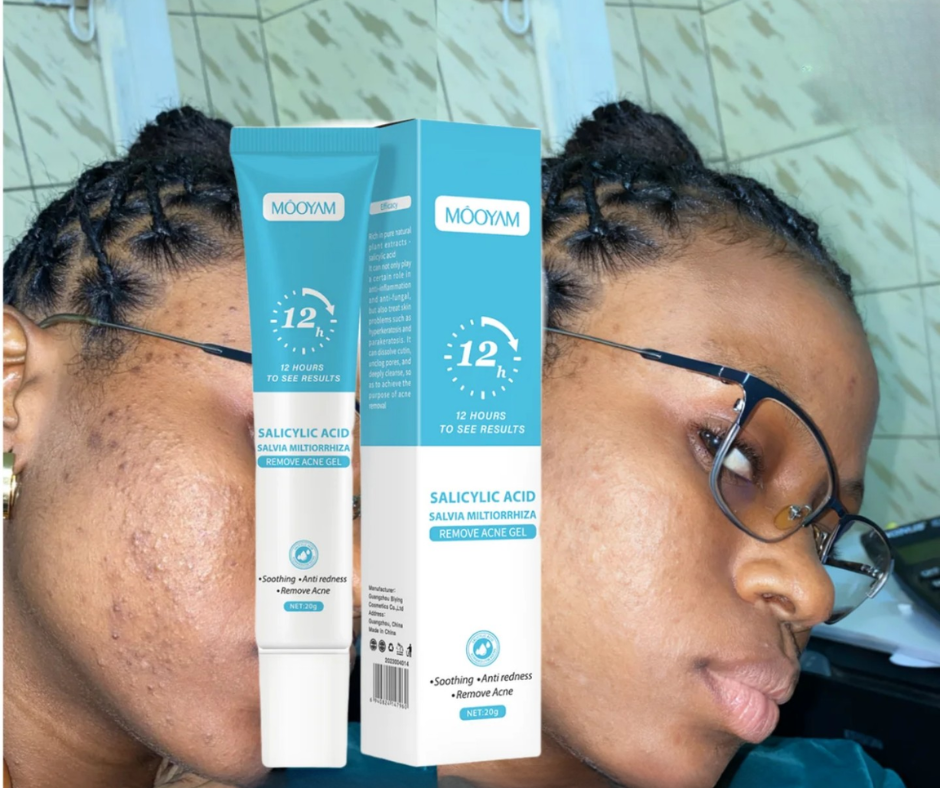 Gel Anti Acné & Anti Taches | Acide Salicylique 2% | Peau Nette en 7 Jours